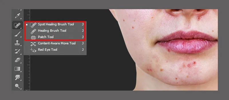 Tools used To Remove Skin Blemishes In Photoshop