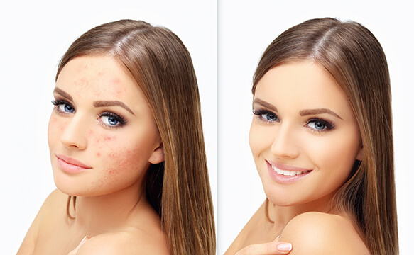 Dust, Spot, and Blemish Removal